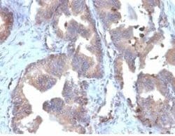 FABP5/E-FABP Rabbit anti-Human, Clone: FABP5/6353R, Novus Biologicals:Antibodies:Primary